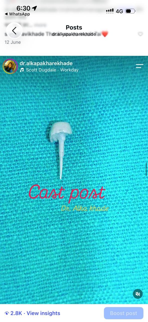 Cast post component on surgical drape